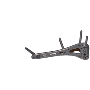 Distal Radius Plate
